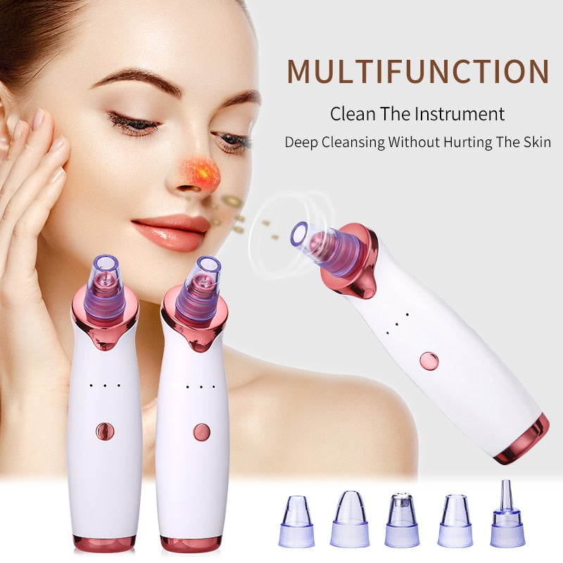 Pore-Cleaning Vacuum – Clear Skin in Minutes