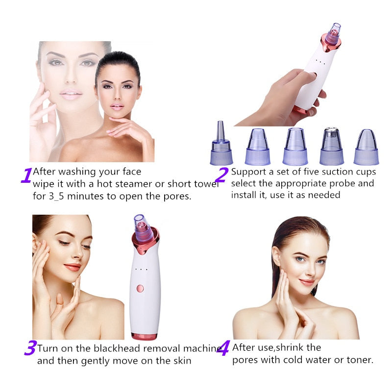 Pore-Cleaning Vacuum – Clear Skin in Minutes