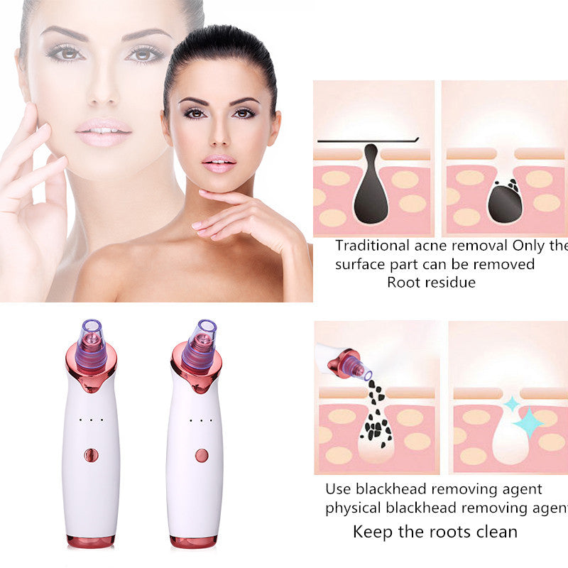 Pore-Cleaning Vacuum – Clear Skin in Minutes