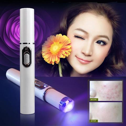 Amazing Portable Blue Light Acne Treatment Device